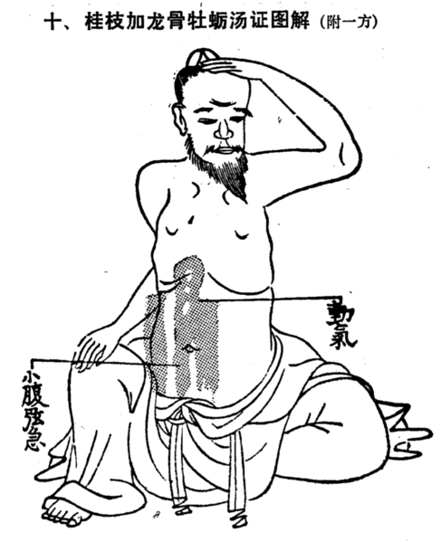 檔案:桂枝加龍骨牡蠣湯腹證.png