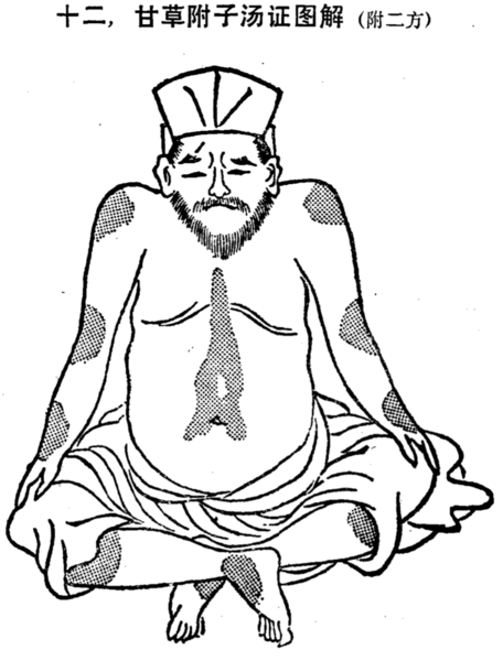檔案:甘草附子湯腹證.png