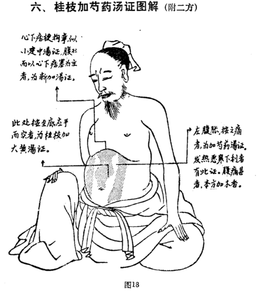檔案:桂枝加芍藥湯腹證.png