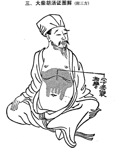 檔案:大柴胡湯腹證.png
