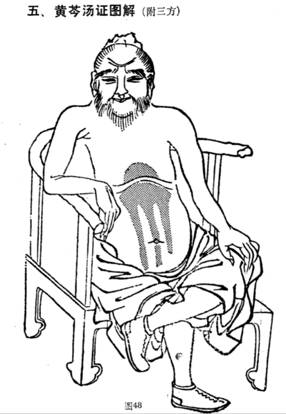 檔案:黃芩湯腹證.png